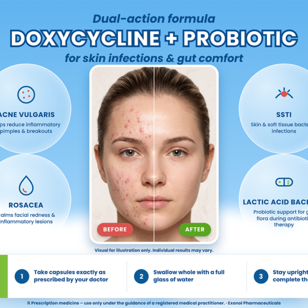 Blue infographic highlighting Doxycycline and Probiotic capsules for acne and rosacea, with usage instructions and a before-and-after skin comparison.